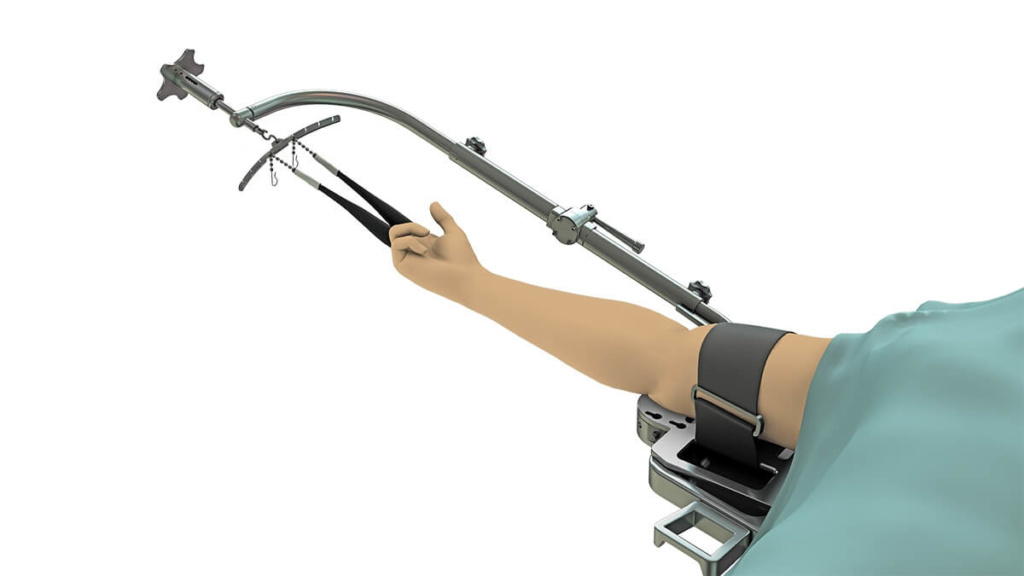 Wrist tower, medical device